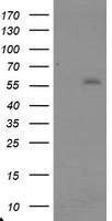 TRAIP / TRIP Antibody - HEK293T cells were transfected with the pCMV6-ENTRY control (Left lane) or pCMV6-ENTRY TRAIP (Right lane) cDNA for 48 hrs and lysed. Equivalent amounts of cell lysates (5 ug per lane) were separated by SDS-PAGE and immunoblotted with anti-TRAIP.