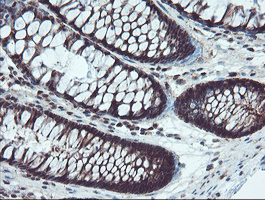 TRAIP / TRIP Antibody - IHC of paraffin-embedded Human colon tissue using anti-TRAIP mouse monoclonal antibody. (Heat-induced epitope retrieval by 10mM citric buffer, pH6.0, 100C for 10min).