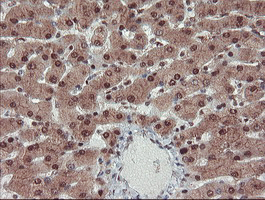 TRAIP / TRIP Antibody - IHC of paraffin-embedded Human liver tissue using anti-TRAIP mouse monoclonal antibody. (Heat-induced epitope retrieval by 10mM citric buffer, pH6.0, 100C for 10min).
