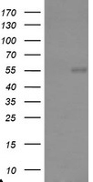 TRAIP / TRIP Antibody - HEK293T cells were transfected with the pCMV6-ENTRY control (Left lane) or pCMV6-ENTRY TRAIP (Right lane) cDNA for 48 hrs and lysed. Equivalent amounts of cell lysates (5 ug per lane) were separated by SDS-PAGE and immunoblotted with anti-TRAIP.
