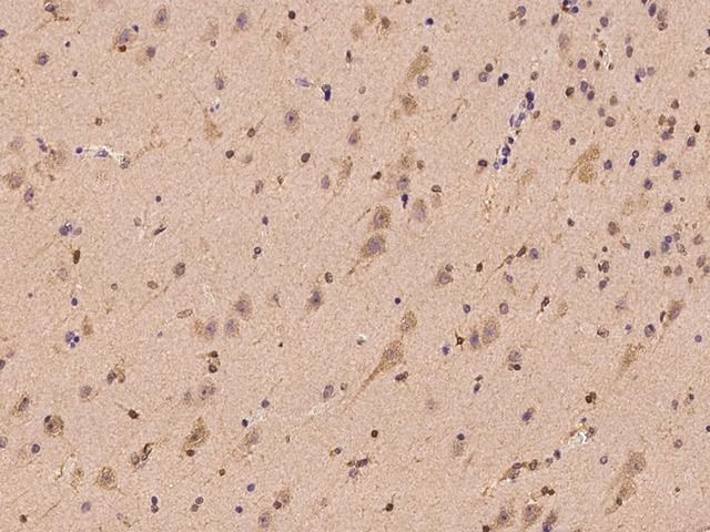 TRAK1 Antibody - Immunochemical staining of human TRAK1 in human brain with rabbit polyclonal antibody at 1:100 dilution, formalin-fixed paraffin embedded sections.