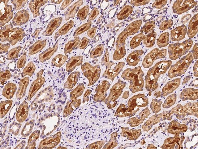 TRAK1 Antibody - Immunochemical staining of human TRAK1 in human kidney with rabbit polyclonal antibody at 1:100 dilution, formalin-fixed paraffin embedded sections.