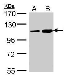 TRAK2 Antibody - Sample (30 ug of whole cell lysate). A: Hep G2 , B: Molt-4 . 7.5% SDS PAGE. TRAK2 antibody diluted at 1:1000