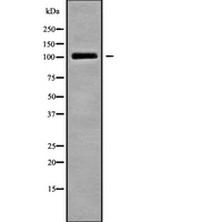 TRAK2 Antibody - Western blot analysis of TRAK2 using LOVO cells whole cells lysates