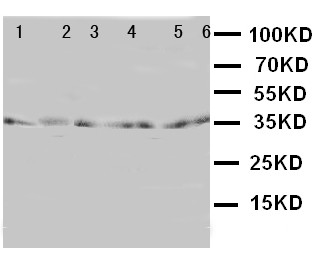 TRAM1 Antibody - WB of TRAM1 antibody. Lane 1: Rat Brain Tissue Lysate. Lane 2: Rat Kidney Tissue Lysate. Lane 3: 293T Cell Lysate. Lane 4: RAJI Cell Lysate. Lane 5: JURKAT Cell Lysate.