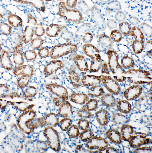 TRAM1 Antibody - TRAM1 antibody. IHC(P): Rat Kidney Tissue.