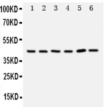 TRAM1 Antibody - Anti-TRAM1 antibody,WB,Lane 1: Rat Brain Tissue Lysate Lane 2: Rat Kidney Tissue Lysate Lane 3: 293T Cell Lysate Lane 4: RAJI Cell Lysate Lane 5: JURKAT Cell Lysate Lane 6: Hela Cell Lysate