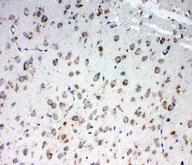 TRAM1 Antibody - IHC analysis of TRAM1 using anti-TRAM1 antibody. TRAM1 was detected in frozen section of rat brain tissues. Heat mediated antigen retrieval was performed in citrate buffer (pH6, epitope retrieval solution) for 20 mins. The tissue section was blocked with 10% goat serum. The tissue section was then incubated with 1µg/ml rabbit anti-TRAM1 Antibody overnight at 4°C. Biotinylated goat anti-rabbit IgG was used as secondary antibody and incubated for 30 minutes at 37°C. The tissue section was developed using Strepavidin-Biotin-Complex (SABC) with DAB as the chromogen.