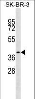 TRAM1 Antibody - TRAM1 Antibody western blot of SK-BR-3 cell line lysates (35 ug/lane). The TRAM1 antibody detected the TRAM1 protein (arrow).