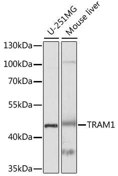 TRAM1 Antibody - Western blot analysis of extracts of various cell lines, using TRAM1 antibody at 1:1000 dilution. The secondary antibody used was an HRP Goat Anti-Rabbit IgG (H+L) at 1:10000 dilution. Lysates were loaded 25ug per lane and 3% nonfat dry milk in TBST was used for blocking. An ECL Kit was used for detection and the exposure time was 10s.
