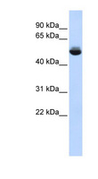 TRAM1L1 Antibody - TRAM1L1 antibody Western blot of Fetal liver lysate. This image was taken for the unconjugated form of this product. Other forms have not been tested.