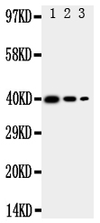 TRAM2 Antibody - Anti-TRAM2 antibody, Western blottingRecombinant Protein Detection Source: E. coli derived -recombinant Mouse TRAM2,39. 0KD (162aa tag+R190-P370)Lane 1: Recombinant Mouse TRAM2 Protein 10ng Lane 2: Recombinant Mouse TRAM2 Protein 5ng Lane 3: Recombinant Mouse TRAM2 Protein 2. 5ng