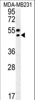 TRAM2 Antibody - TRAM2 Antibody western blot of MDA-MB231 cell line lysates (35 ug/lane). The TRAM2 antibody detected the TRAM2 protein (arrow).
