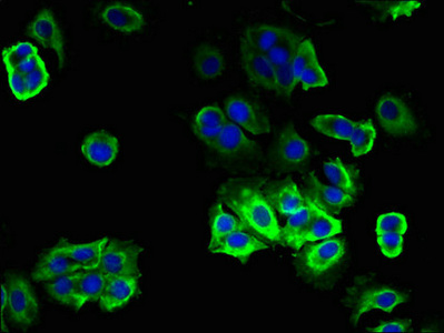 TRAM2 Antibody - Immunofluorescent analysis of MCF-7 cells using TRAM2 Antibody at dilution of 1:100 and Alexa Fluor 488-congugated AffiniPure Goat Anti-Rabbit IgG(H+L)