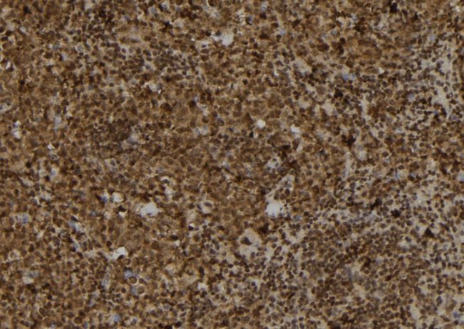 TRAM2 Antibody - 1:100 staining mouse spleen tissue by IHC-P. The sample was formaldehyde fixed and a heat mediated antigen retrieval step in citrate buffer was performed. The sample was then blocked and incubated with the antibody for 1.5 hours at 22°C. An HRP conjugated goat anti-rabbit antibody was used as the secondary.