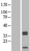 TRAM2 Protein - Western validation with an anti-DDK antibody * L: Control HEK293 lysate R: Over-expression lysate