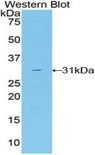 Transaldolase Antibody - Western blot of recombinant TALDO1 / TAL.  This image was taken for the unconjugated form of this product. Other forms have not been tested.