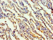 Transaldolase Antibody - Immunohistochemistry of paraffin-embedded human lung tissue using TALDO1 Antibody at dilution of 1:100