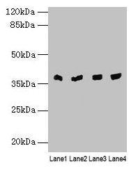 Transaldolase Antibody - Western blot All lanes: TALDO1 antibody at 0.1µg/ml Lane 1: Human placenta tissue Lane 2: Hela whole cell lysate Lane 3: Jurkat whole cell lysate Lane 4: A375 whole cell lysate Secondary Goat polyclonal to rabbit IgG at 1/10000 dilution Predicted band size: 38 kDa Observed band size: 38 kDa