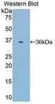 Transferrin / Transferrin Receptor Antibody