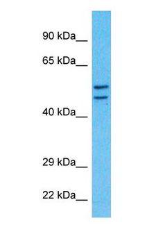 Translokin / CEP57 Antibody - Western blot of CEP57 Antibody with human Fetal Liver lysate.  This image was taken for the unconjugated form of this product. Other forms have not been tested.