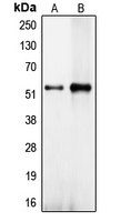 Translokin / CEP57 Antibody - Western blot analysis of CEP57 expression in NT2D1 (A); HeLa (B) whole cell lysates.