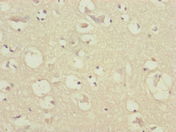 Translokin / CEP57 Antibody - Immunohistochemistry of paraffin-embedded human brain tissue at dilution of 1:100