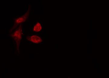 Translokin / CEP57 Antibody - Staining COLO205 cells by IF/ICC. The samples were fixed with PFA and permeabilized in 0.1% Triton X-100, then blocked in 10% serum for 45 min at 25°C. The primary antibody was diluted at 1:200 and incubated with the sample for 1 hour at 37°C. An Alexa Fluor 594 conjugated goat anti-rabbit IgG (H+L) antibody, diluted at 1/600, was used as secondary antibody.