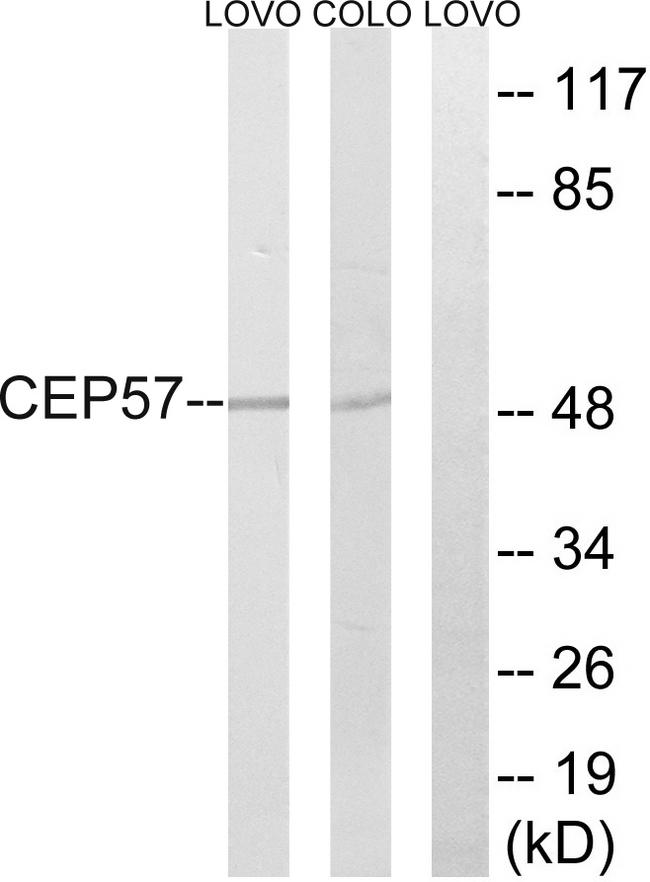 Translokin / CEP57 Antibody - Western blot analysis of extracts from LOVO cells and COLO cells, using MRPS7 antibody.