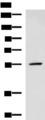Translokin / CEP57 Antibody - Western blot analysis of A549 cell lysate  using CEP57 Polyclonal Antibody at dilution of 1:600