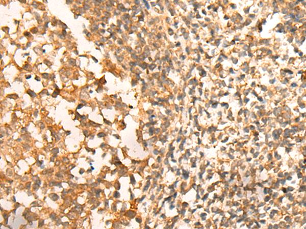 Translokin / CEP57 Antibody - Immunohistochemistry of paraffin-embedded Human tonsil tissue  using CEP57 Polyclonal Antibody at dilution of 1:30(×200)