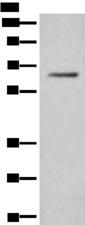 Translokin / CEP57 Antibody - Western blot analysis of Hela cell lysate  using CEP57 Polyclonal Antibody at dilution of 1:450