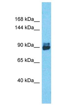 Transportin-SR / TNPO3 Antibody - Transportin-SR / TNPO3 antibody Western Blot of MCF7. Antibody dilution: 1 ug/ml.  This image was taken for the unconjugated form of this product. Other forms have not been tested.
