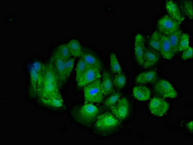 Transportin-SR / TNPO3 Antibody - Immunofluorescent analysis of HepG2 cells diluted at 1:100 and Alexa Fluor 488-congugated AffiniPure Goat Anti-Rabbit IgG(H+L)