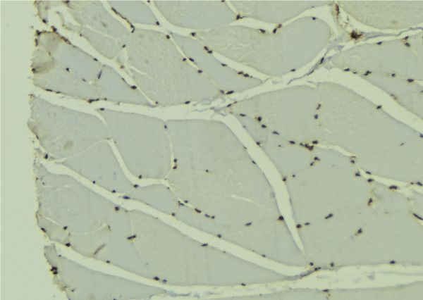 Transportin-SR / TNPO3 Antibody - 1:100 staining mouse muscle tissue by IHC-P. The sample was formaldehyde fixed and a heat mediated antigen retrieval step in citrate buffer was performed. The sample was then blocked and incubated with the antibody for 1.5 hours at 22°C. An HRP conjugated goat anti-rabbit antibody was used as the secondary.