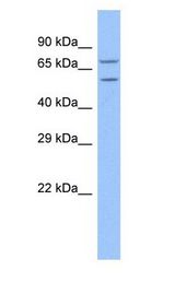 TRAP1 / HSP75 Antibody - TRAP1 / HSP75 antibody Western Blot of HeLa.  This image was taken for the unconjugated form of this product. Other forms have not been tested.
