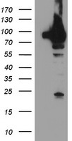 TRAP1 / HSP75 Antibody - HEK293T cells were transfected with the pCMV6-ENTRY control (Left lane) or pCMV6-ENTRY TRAP1 (Right lane) cDNA for 48 hrs and lysed. Equivalent amounts of cell lysates (5 ug per lane) were separated by SDS-PAGE and immunoblotted with anti-TRAP1.
