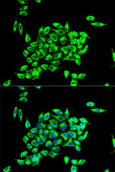 TRAP1 / HSP75 Antibody - Immunofluorescence analysis of HeLa cells.