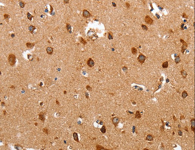 TRAP1 / HSP75 Antibody - Immunohistochemistry of paraffin-embedded Human brain using TRAP1 Polyclonal Antibody at dilution of 1:60.