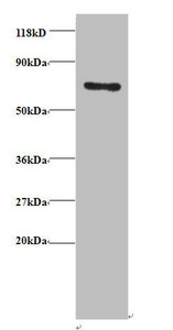 TRAP1 / HSP75 Antibody - Western blot All Lanes: Heat shock protein 75 kDa, mitochondrialantibody at 2ug/ml+EC109whole cell lysate Secondary Goat polyclonal to Rabbit IgG at 1/15000 dilution Predicted band size: 81,75 kDa Observed band size: 75 kDa