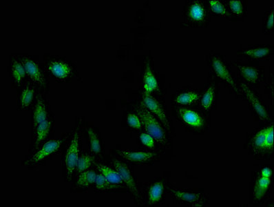 TRAP1 / HSP75 Antibody - Immunofluorescent analysis of Hela cells using TRAP1 Antibody at dilution of 1:100 and Alexa Fluor 488-congugated AffiniPure Goat Anti-Rabbit IgG(H+L)