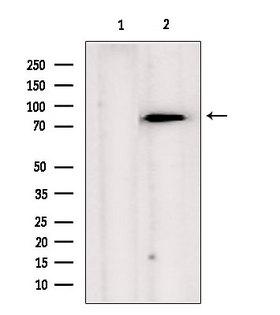 TRAP1 / HSP75 Antibody - Western blot analysis of extracts of HeLa cells using TRAP1 antibody. Lane 1 was treated with the blocking peptide.