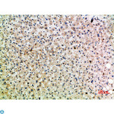 TRAP1 / HSP75 Antibody - Immunohistochemical analysis of paraffin-embedded human-liver, antibody was diluted at 1:200.