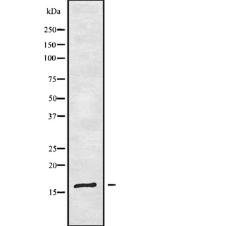 TRAPPC1 / MUM2 Antibody - Western blot analysis of TRAPPC1 using COS7 whole cells lysates