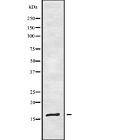 TRAPPC1 / MUM2 Antibody - Western blot analysis of TRAPPC1 using COS7 whole cells lysates