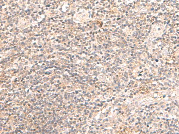 TRAPPC1 / MUM2 Antibody - Immunohistochemistry of paraffin-embedded Human tonsil tissue  using TRAPPC1 Polyclonal Antibody at dilution of 1:50(×200)