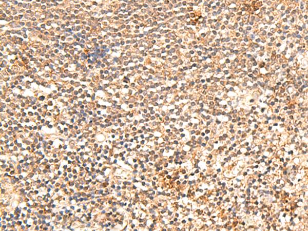 TRAPPC1 / MUM2 Antibody - Immunohistochemistry of paraffin-embedded Human tonsil tissue  using TRAPPC1 Polyclonal Antibody at dilution of 1:60(×200)