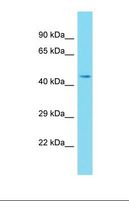 TRAPPC13 / C5orf44 Antibody - Western blot of Human MCF7. C5orf44 antibody dilution 1.0 ug/ml.  This image was taken for the unconjugated form of this product. Other forms have not been tested.