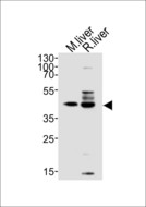 TRAPPC13 / C5orf44 Antibody - Western blot of lysates from mouse liver, rat liver tissue lysate (from left to right), using C5orf44 antibody diluted at 1:1000 at each lane. A goat anti-rabbit IgG H&L (HRP) at 1:10000 dilution was used as the secondary antibody. Lysates at 20 ug per lane.