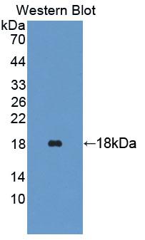 TRAPPC2 / SEDL Antibody - Western blot of TRAPPC2 / SEDL antibody.